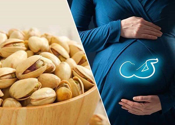 انتخاب آیا پسته تازه برای بارداری عوارض دارد؟ آیا پسته تازه برای بارداری عوارض دارد؟